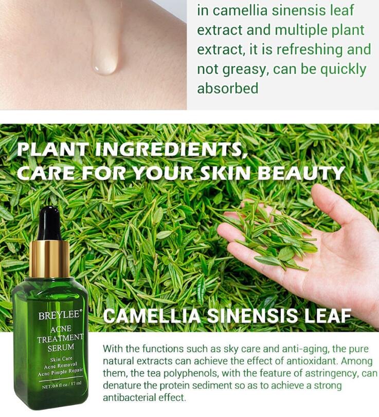 Acne Treatment Serum Facial Repair Oil - Body Bliss Essentials