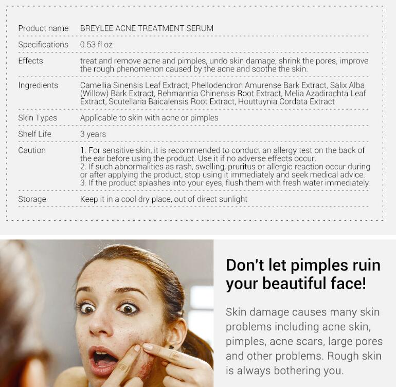 Acne Treatment Serum Facial Repair Oil - Body Bliss Essentials