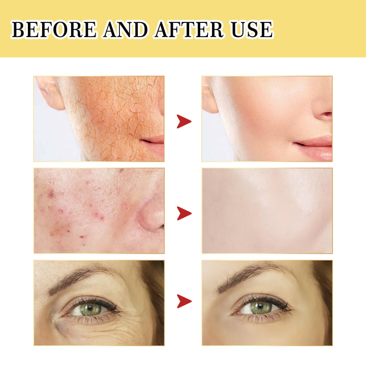Snail Serum Collagen Facial Serum Original - Body Bliss Essentials