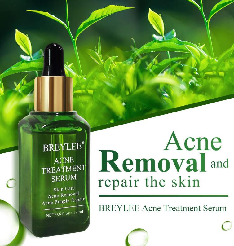 Acne Treatment Serum Facial Repair Oil - Body Bliss Essentials