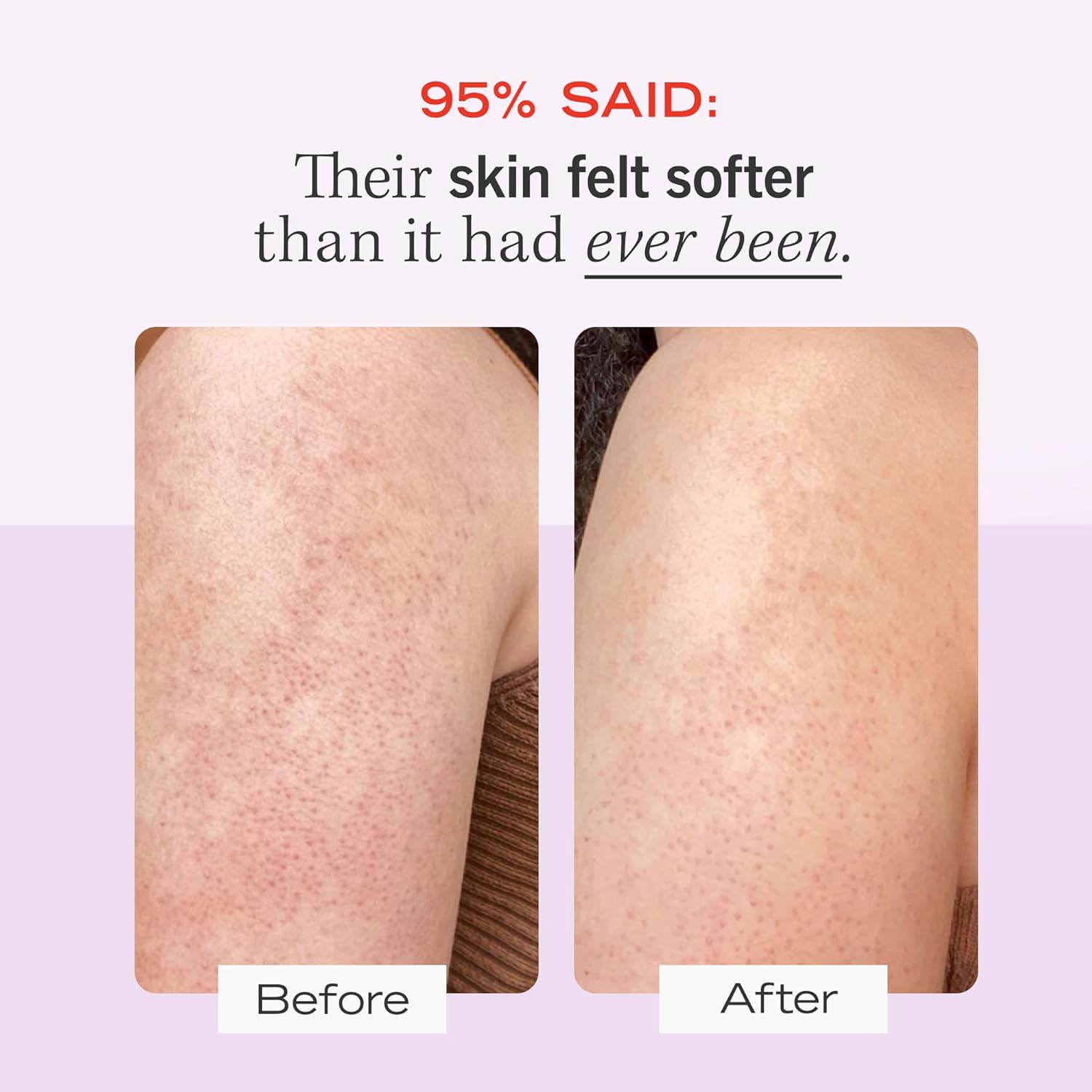 First Aid Beauty - KP Bump Eraser Body Scrub - Body Bliss Essentials