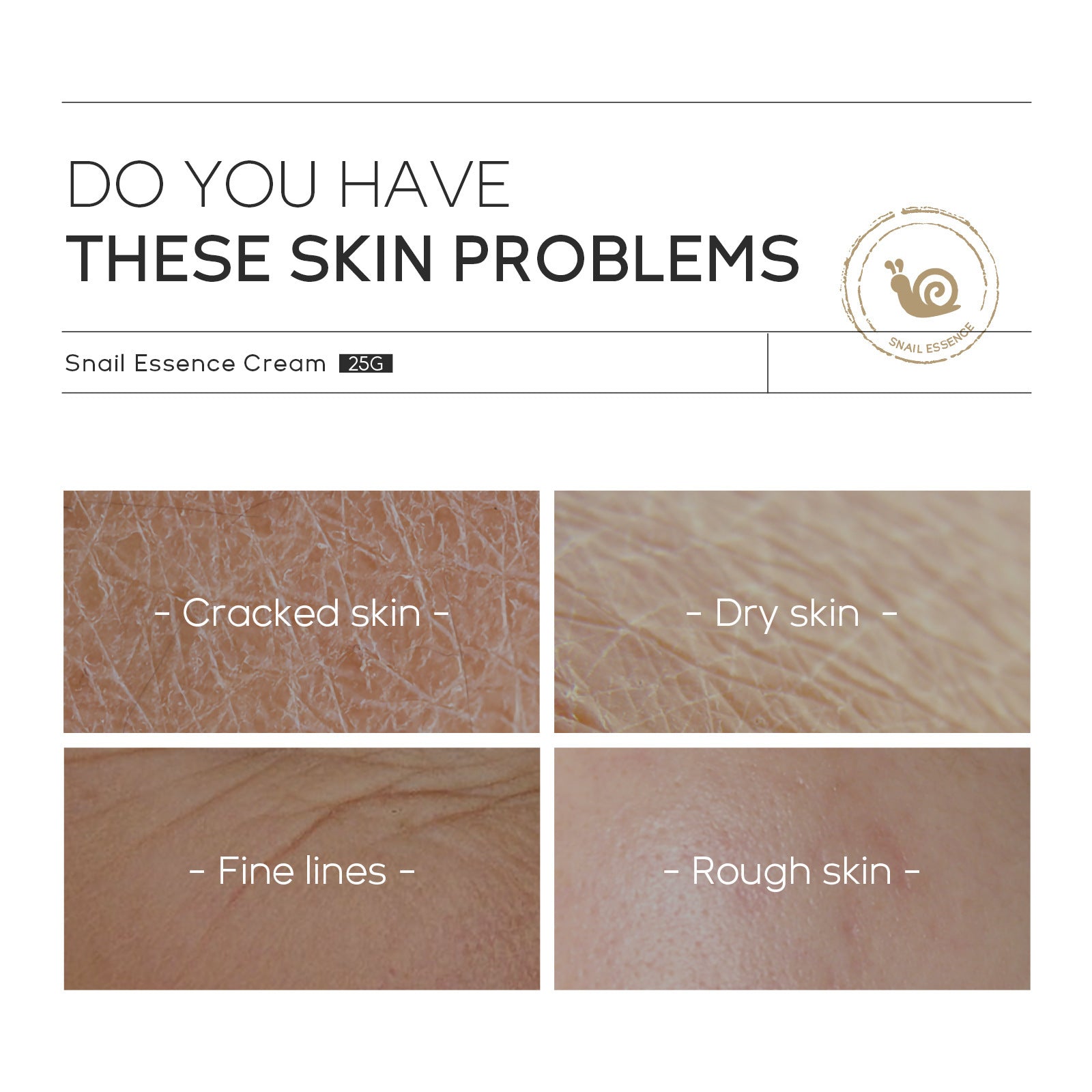 Moisturizing Skin Care Products Laikou Snail Cream - Body Bliss Essentials