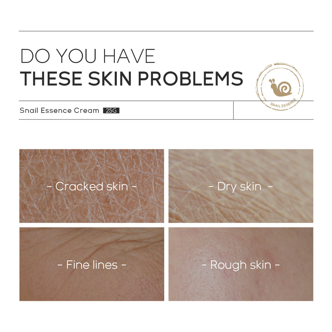Moisturizing Skin Care Products Laikou Snail Cream - Body Bliss Essentials