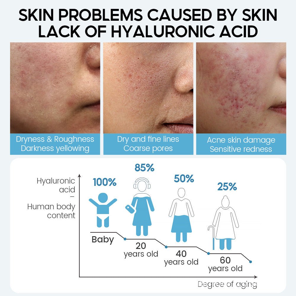 Hyaluronic Acid Face Serum Anti - Aging Shrink Pore Whitening Moisturizing Face Cream Dry Skin Care - Body Bliss Essentials
