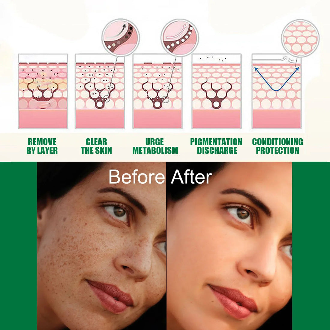 Whitening Freckle Serum Fade Pigmentation Moisturizing Face Care Essence - Body Bliss Essentials