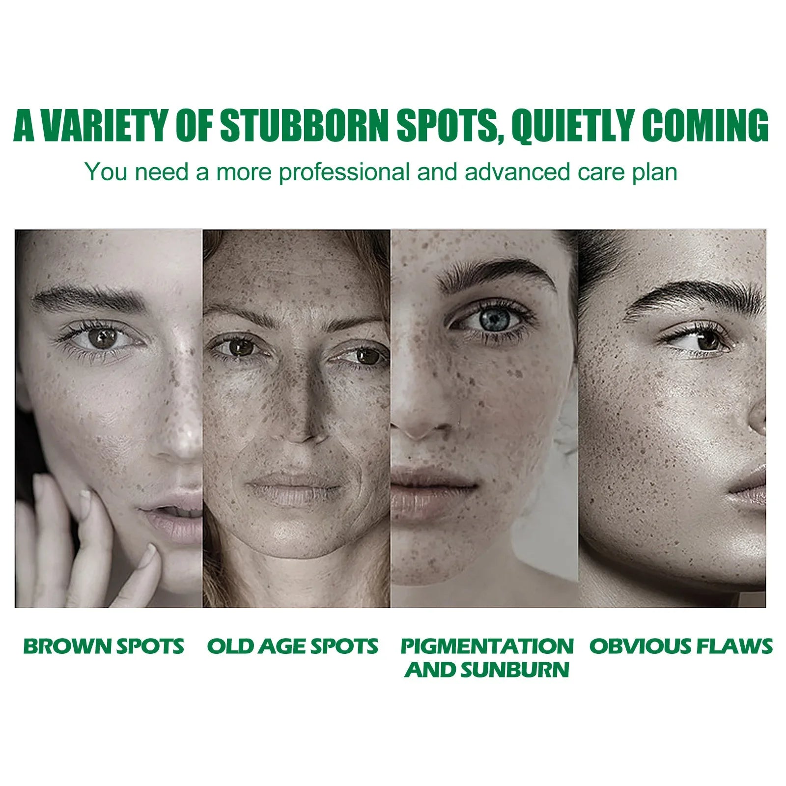 Whitening Freckle Serum Fade Pigmentation Moisturizing Face Care Essence - Body Bliss Essentials