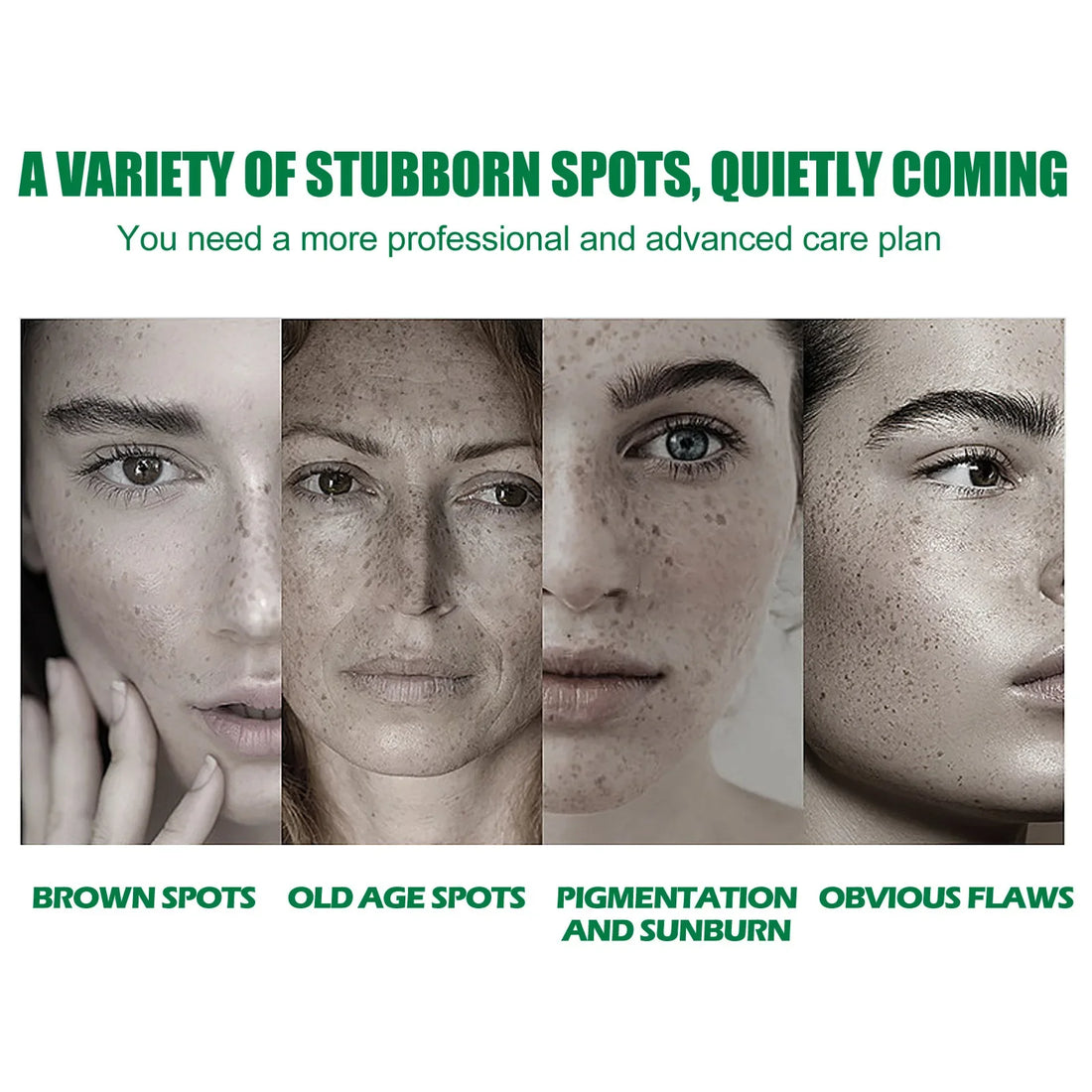 Whitening Freckle Serum Fade Pigmentation Moisturizing Face Care Essence - Body Bliss Essentials