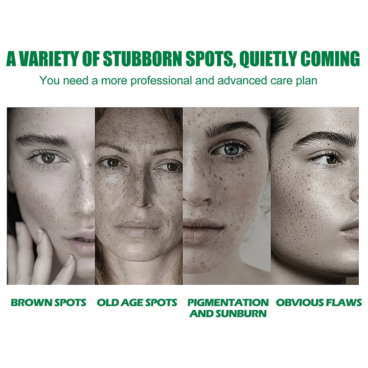 Whitening Freckle Serum Fade Pigmentation Moisturizing Face Care Essence - Body Bliss Essentials