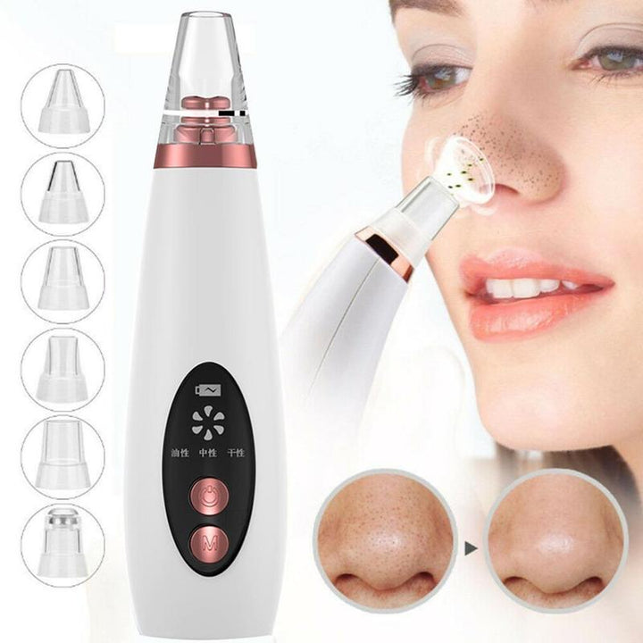 Blackhead Pore Vacuum Cleaner Nose Cleanser Blackheads Remover Blackhead Acne Removal Button Face Suction Beauty Skin Care Tool - Body Bliss Essentials